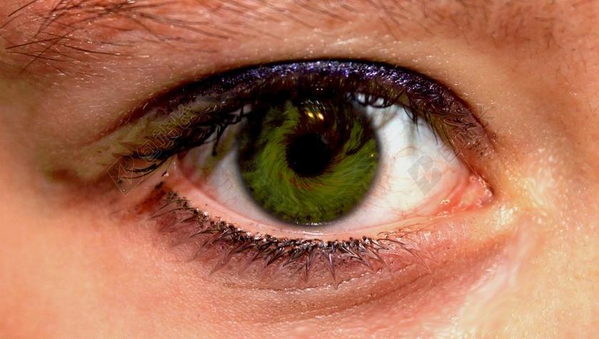 医学医疗眼镜布满血丝背景图片