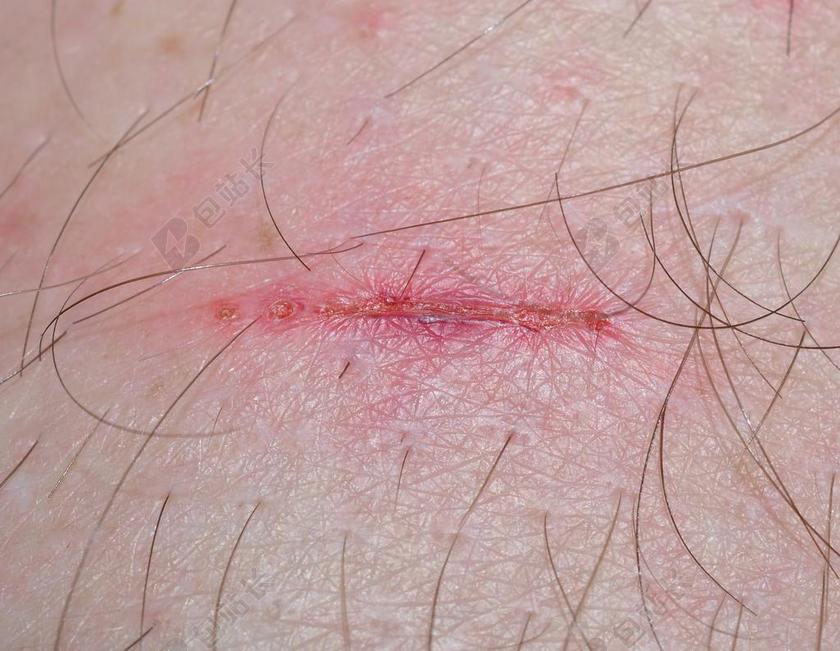 伤口 损伤 时间治愈一切 奇迹的地方 安慰 弗里施