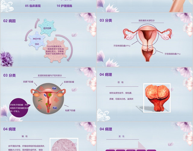 紫色清新子宫肌瘤护理查房PPT课件模板