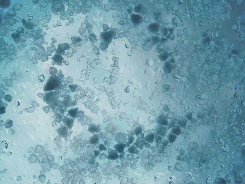 冰雹在窗玻璃谷物 4 月的天气 冰雹 冰 冷 天气 性质 春天