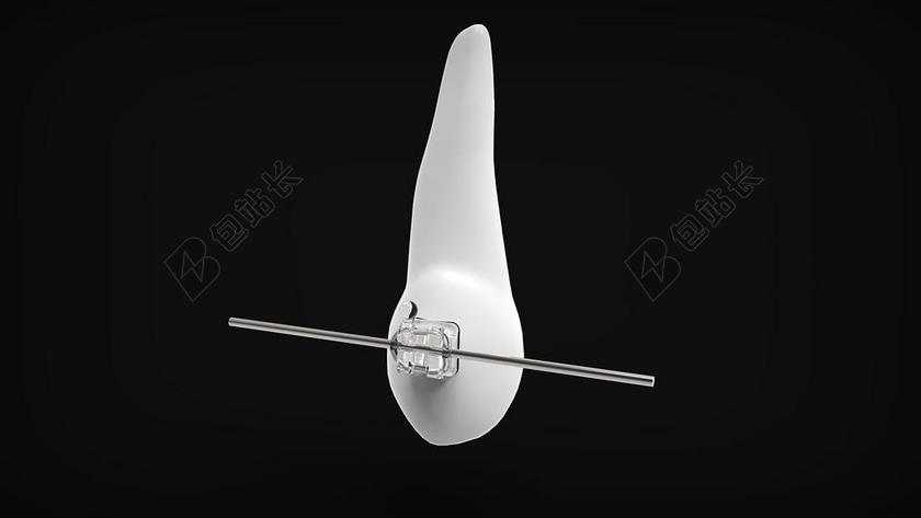 医学医疗畸齿矫正术线背景图片