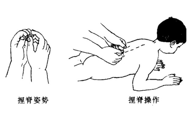 小儿捏脊养生
