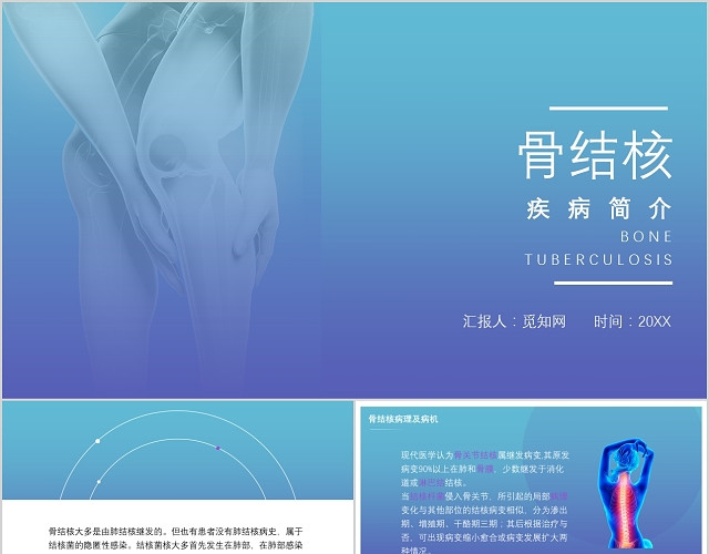 蓝紫色清新骨结核疾病介绍PPT模板