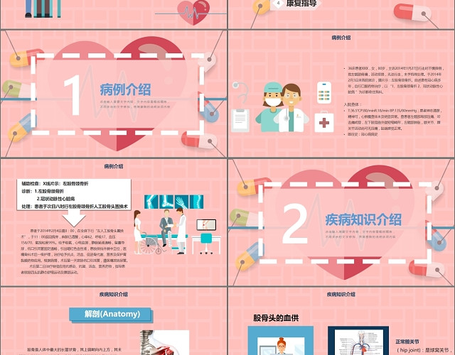 股骨颈骨折护理查房医疗培训PPT模板