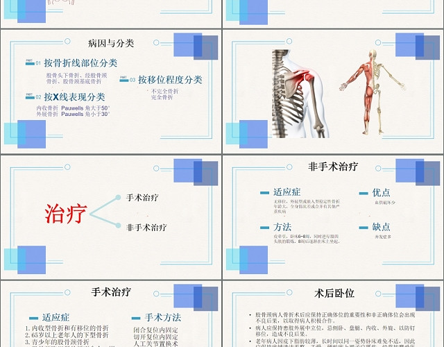 股骨颈骨折的护理PPT模板