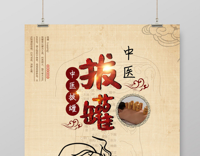 中医养生拔罐宣传海报