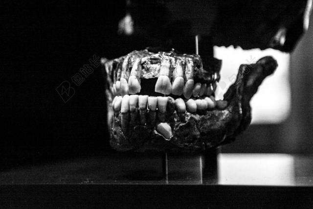 牙 骨 头骨 老 黑色和白色 牙科 口 医疗保健 脸 牙医