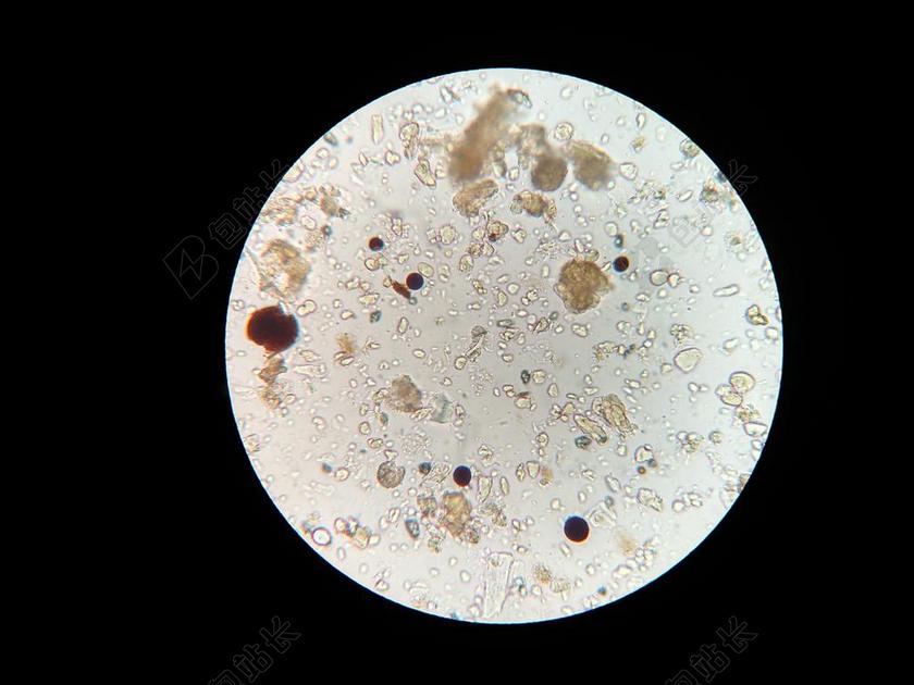 土壤中的微生物显微镜土壤样品科技背景图片