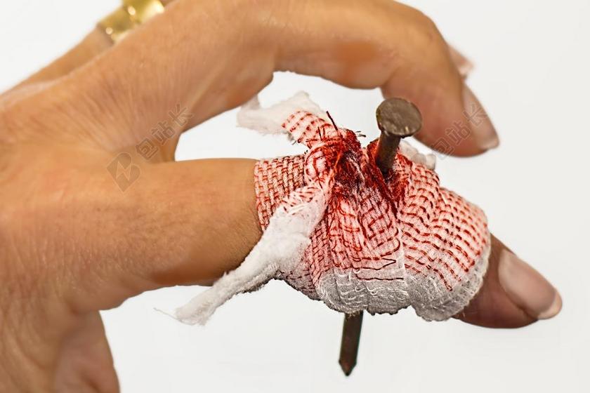 受伤钉子扎手背景图片