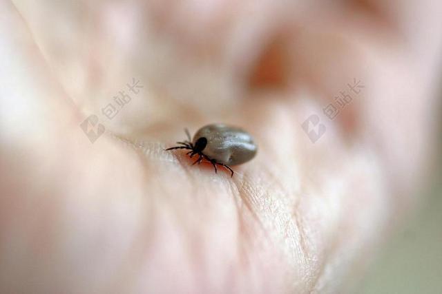 刻度线 木头刻度线 血抽油 手 动物 生物 螨类