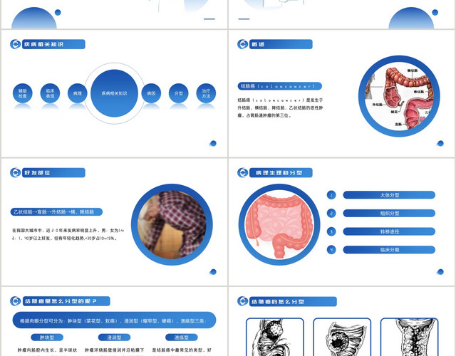 蓝色简约风结肠癌病人护理查房PPT模板