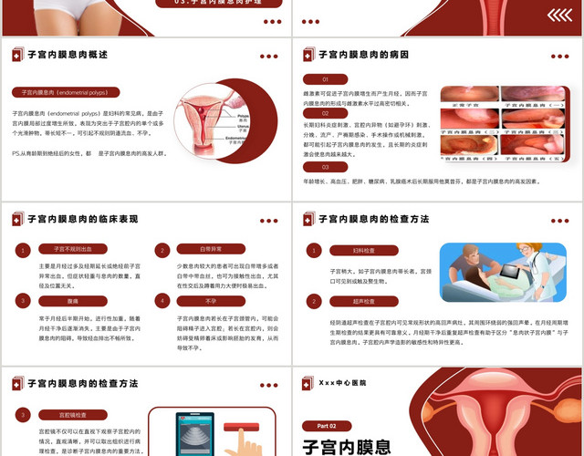 红色简约风格子宫内膜息肉的护理PPT模板