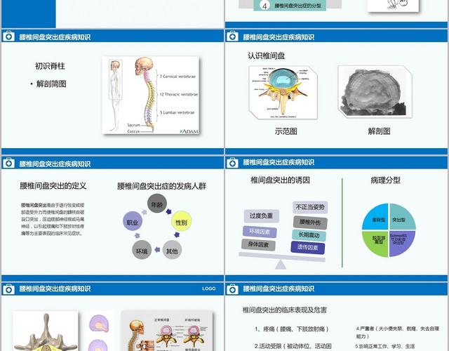 蓝色医疗腰椎间盘突出症知识培训腰椎骨科护理查房PPT模板