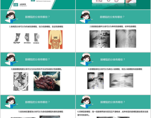 绿色清新肠梗阻护理常规护理查房培训PPT模板