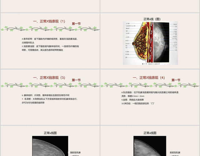 淡黄色手绘乳腺肿物护理查房PPT模板