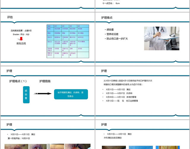 蓝色医疗压疮患者护理查房压疮病例PPT模板