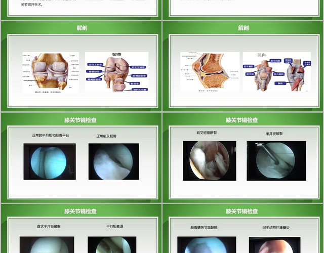 绿色医疗膝关节镜护理业务查房膝关节护理查房PPT模板