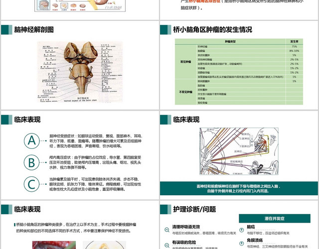 深绿色简约小脑肿瘤术后护理查房PPT模板