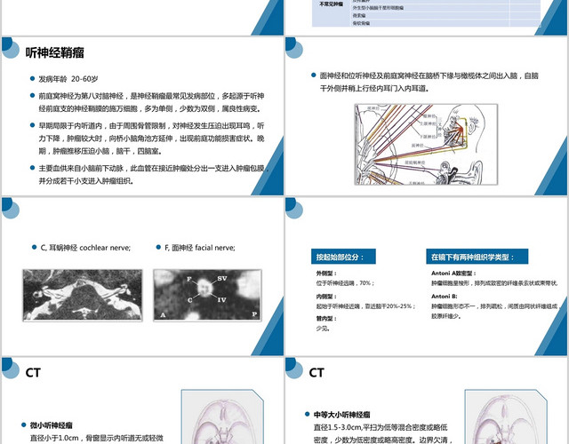 蓝色简约桥小脑角区肿瘤介绍护理查房PPT模板