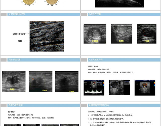 浅色乳腺肿物护理查房PPT模板