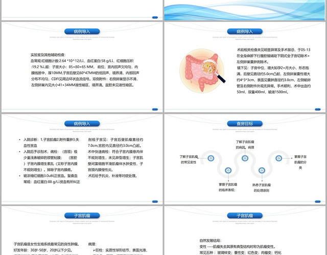 蓝色线条简约风教学查房子宫肌瘤护理查房PPT模板