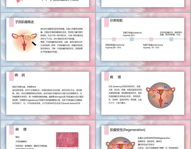 蓝粉色羽毛梦幻风子宫肌瘤护理查房PPT模板