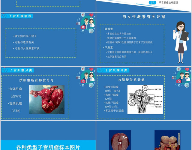蓝色医疗子宫肌瘤课件PPT模板