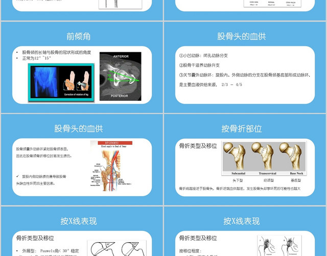 蓝色卡通股骨骨折的护理培训介绍PPT模板