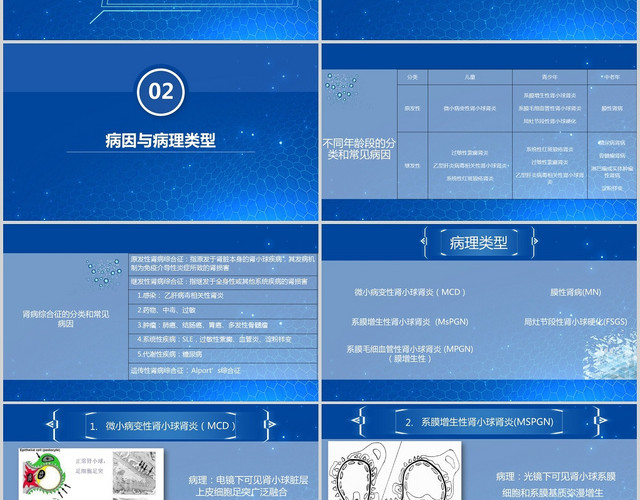 蓝色科技风肾病综合征PPT模板