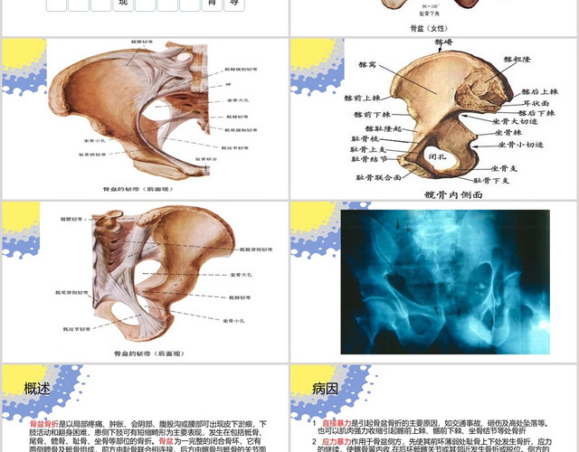 白色 说课风 课件 多发骨盆骨折护理查房 PPT模板