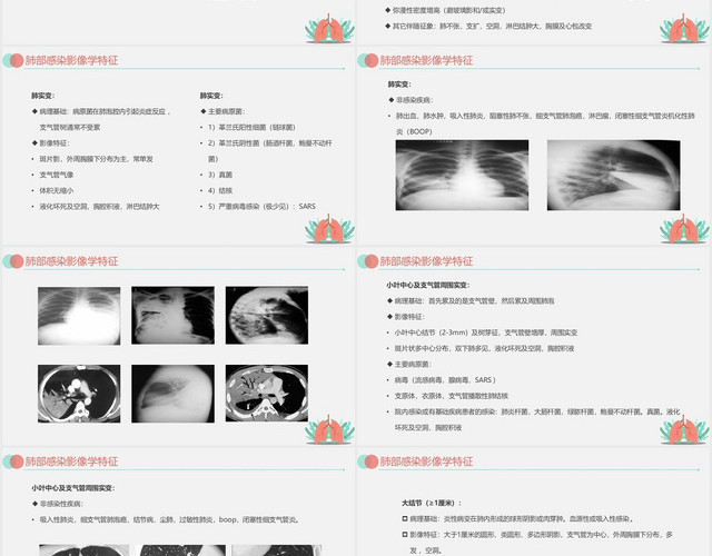 灰色简约风肺部感染护理查房肺部感染影像学特征PPT模板