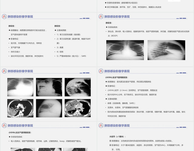 灰色简约风肺部感染护理查房肺部感染影像学表现PPT模板