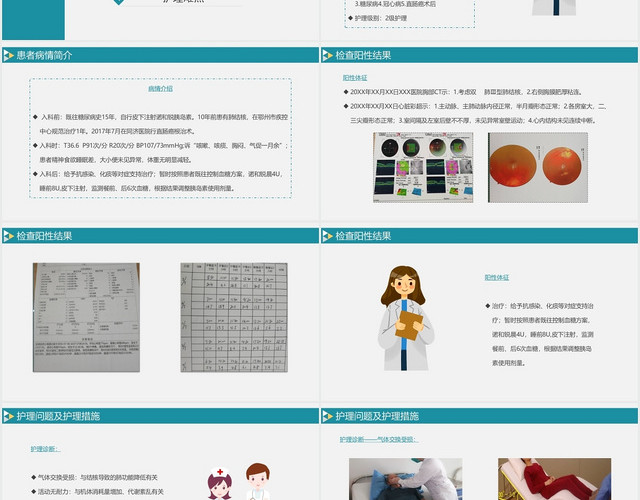 蓝色简约风疑难病例讨论疑难病例讨论PPT模板