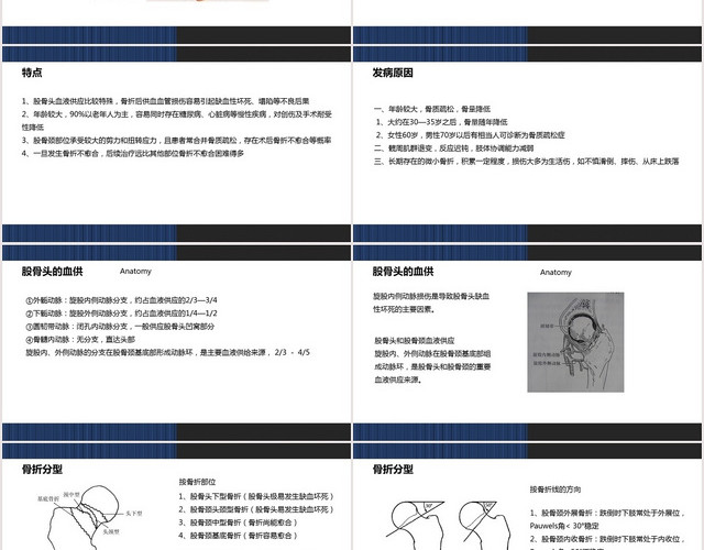 蓝色扁平股骨颈骨折护理查房股骨颈骨折PPT模板