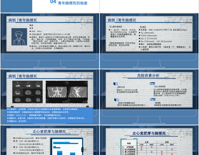 雾蓝高端医学知识风格青年脑梗死课题培训讲座PPT脑梗死护理查房PPT