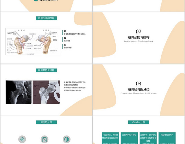 黄绿色股骨颈骨折护理查房医疗课件PPT模板