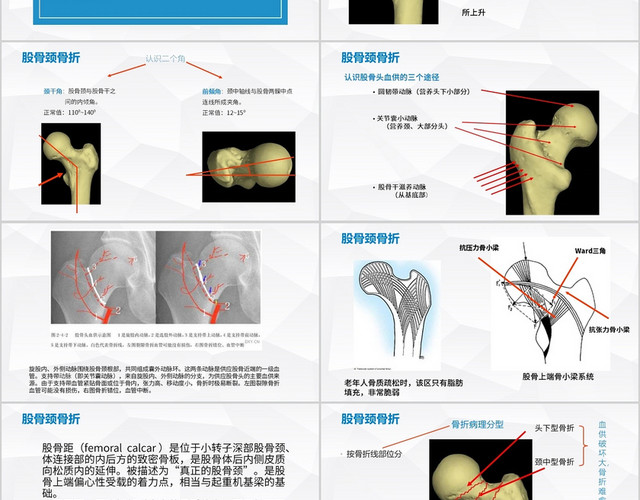 蓝色简约风教学课件医学医疗股骨颈骨骨折PPT模板