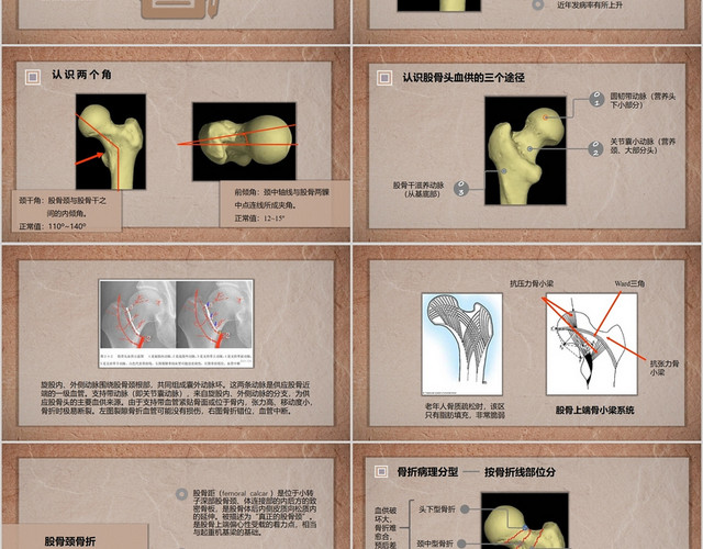 浅褐色简约风医疗课件股骨颈骨折PPT模板