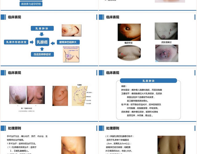 蓝色扁平乳腺癌术后护理查房PPT模板