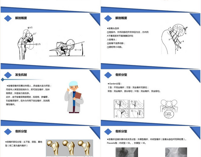 蓝色扁平股骨颈骨折护理查房股骨颈骨折PPT模板