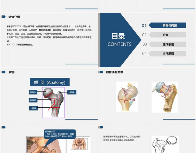 蓝色扁平股骨颈骨折的护理PPT模板