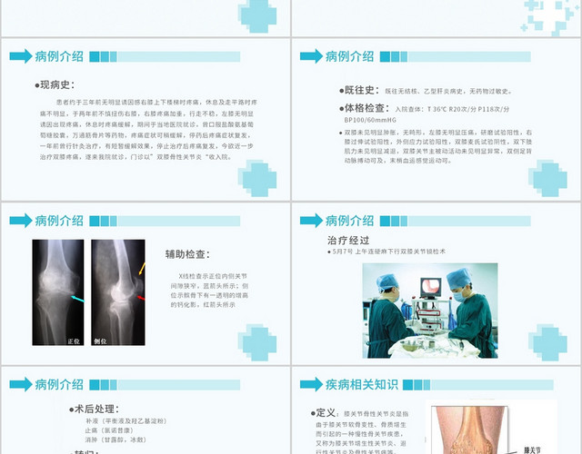 蓝色简约风医学医疗双膝关节炎护理查房PPT模板