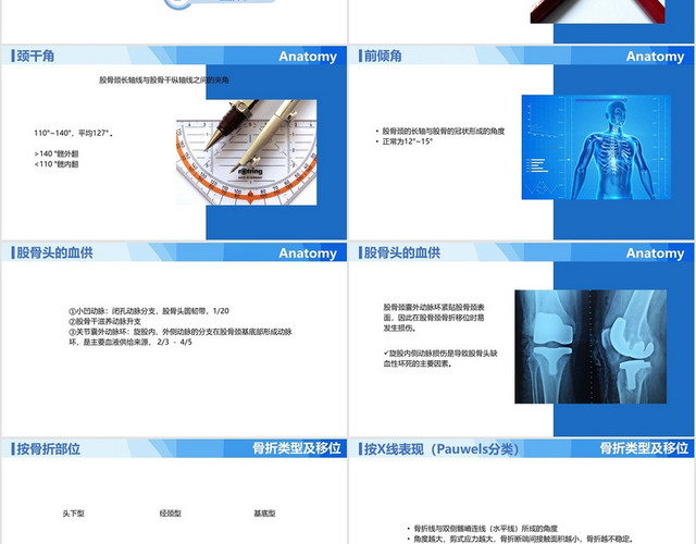 蓝色商务风医学股骨颈骨折PPT模板