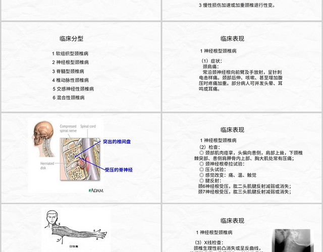 商务风颈椎病查房护理颈椎病病人的护理PPT模板