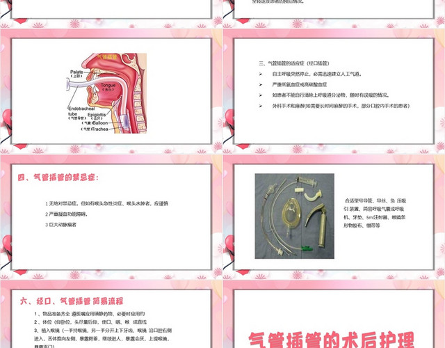 粉红色简约风气管插管的护理课件气管插管的护理PPT模板