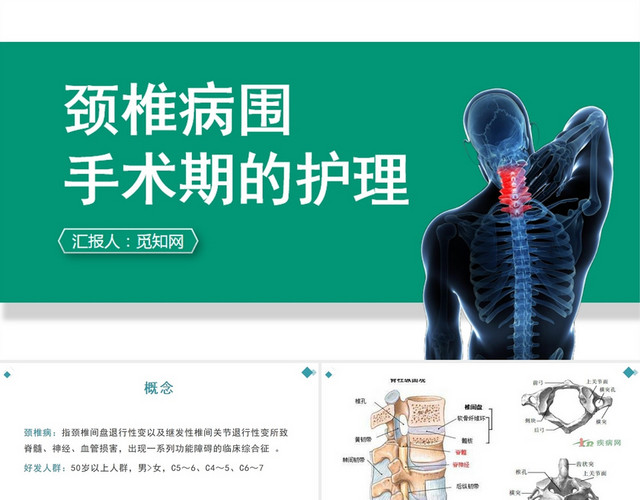 蓝色颈椎病围手术期的护理查房治疗PPT