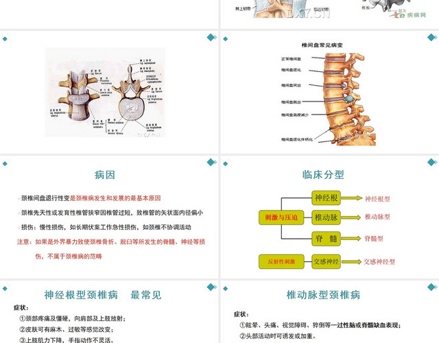 蓝色颈椎病围手术期的护理查房治疗PPT