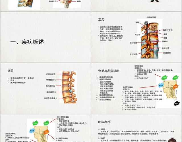 灰色简洁风课件颈椎病个案护理查房PPT模板