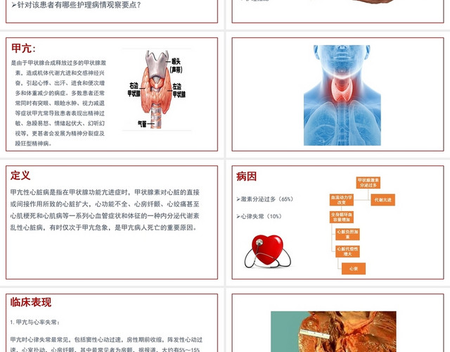 白色背景甲亢心脏病PPT模板