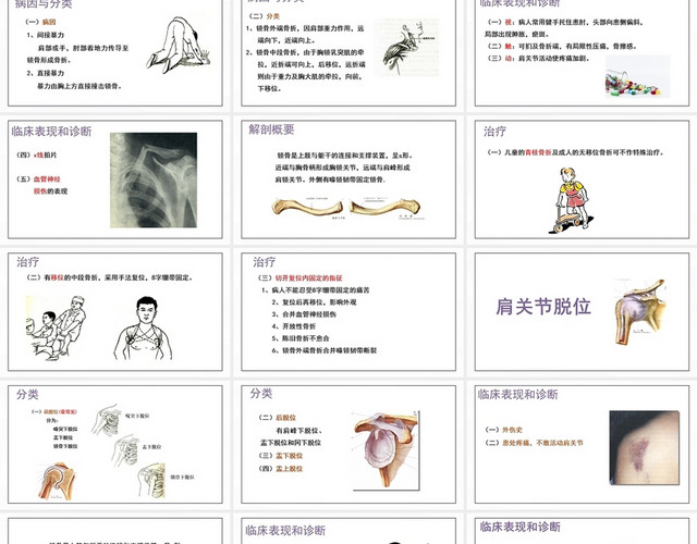 紫色简约风上肢骨关节损伤PPT模板